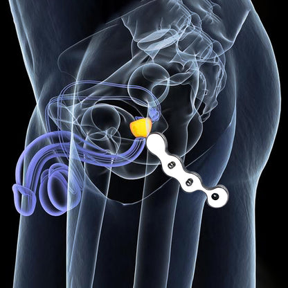 Wave-Shaped Prostate Massager with Nylon Cord and Pull Ring, F3182 - FRRK